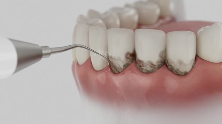 Trusted Root Canal Treatment service in Amherst, VA - Dentist Open Now